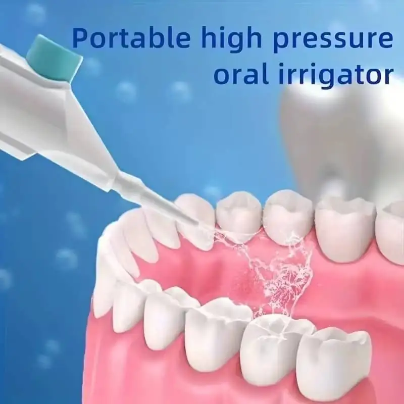 PORTABLE HOUSEHOLD HIGH PRESSURE ORAL IRRIGATOR